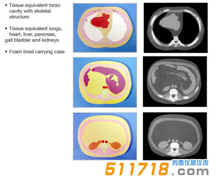 1534930647972879.jpg 美國CIRS 600 3D截面軀干模型模體.jpg