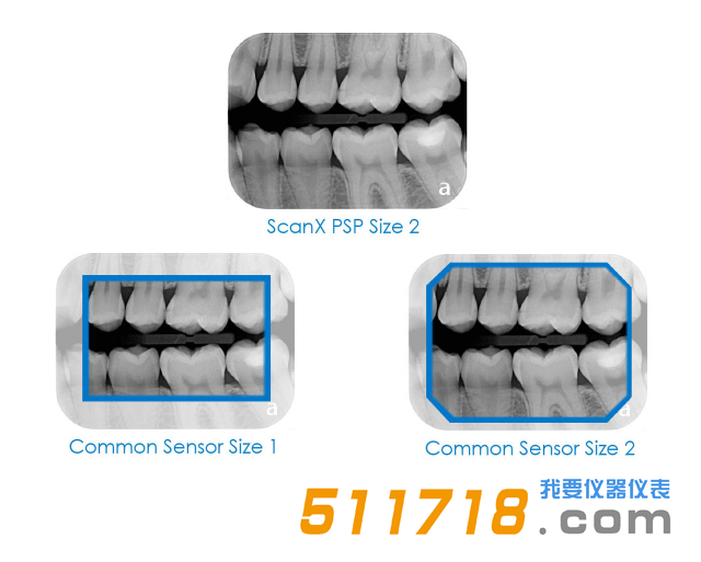 1557221931523171.png 美國(guó)AIR TECHNIQUES ScanX Duo數(shù)字X射線(xiàn)系統(tǒng) 口腔掃描儀2.png